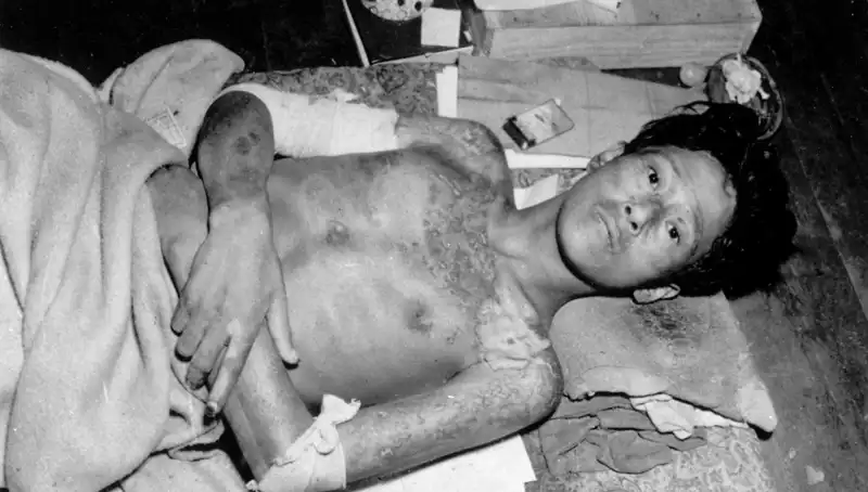 80 Yıl Sonra Nagasaki'den Sesleniş: Nükleer Tehditler Artıyor