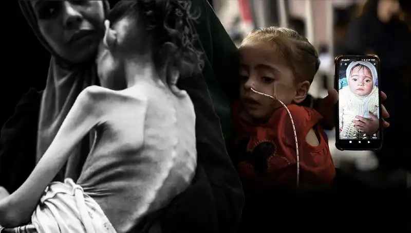 Küçük Meryem’in Açlıkla Mücadelesi: 25 Kilodan 10 Kiloya Düştü